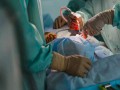  العرب اليوم - إجراء أول عملية جراحية عن بعد بواسطة إنسان آلي محلي الصنع في إيران