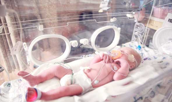 علاج طفلة من اضطراب نادر قاتل قبل الولادة