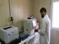  العرب اليوم - كشف أول الأعراض سرطان البنكرياس