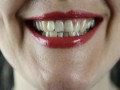  العرب اليوم - آلام الأسنان قَدْ تَكُونُ علامة على الْمُعَانَاة من "دودة الفم"