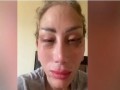  العرب اليوم - الإعلامية ريهام سعيد تكشف عن تشوه وجهها على يد طبيب تجميل شهير