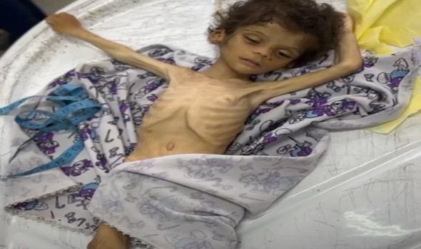  العرب اليوم - الذكاء الإصطناعي يخطأ بإتهام نائب فرنسي إستخدام صورة غير صحيحة للمجاعة في غزّة
