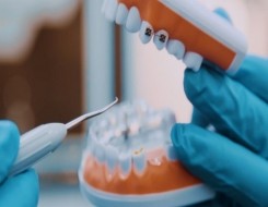  العرب اليوم - تحركات علمية نحو إعادة إنماء الأسنان المفقودة بديلًا عن العلاجات التقليدية